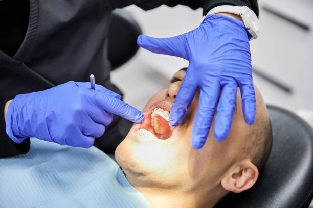 Best Emergency Dentist for Lost Fillings or Crowns in Frankfort, IN
